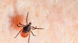 Der Gemeine Holzbock ist die häufigste Zeckenart in Deutschland und auch die, die hauptsächlich FSME und Borreliose auf den Menschen übertragt. (Archivbild)